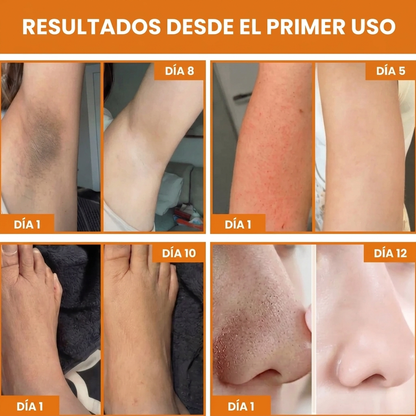 Gel Exfoliante Orange, Limpia tu Piel en Menos de 1 Semana